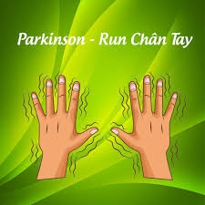 Loại bỏ Parkinson bằng Đông y tại nhà